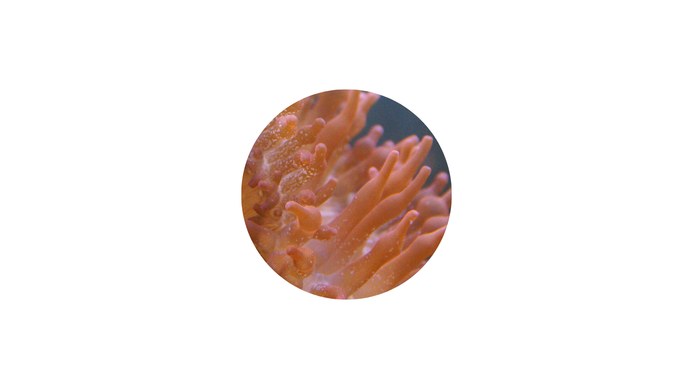 Darmsanierung Colitis Ulcerosa Morbus Crohn Praxis für Darmgesundheit Leipzig